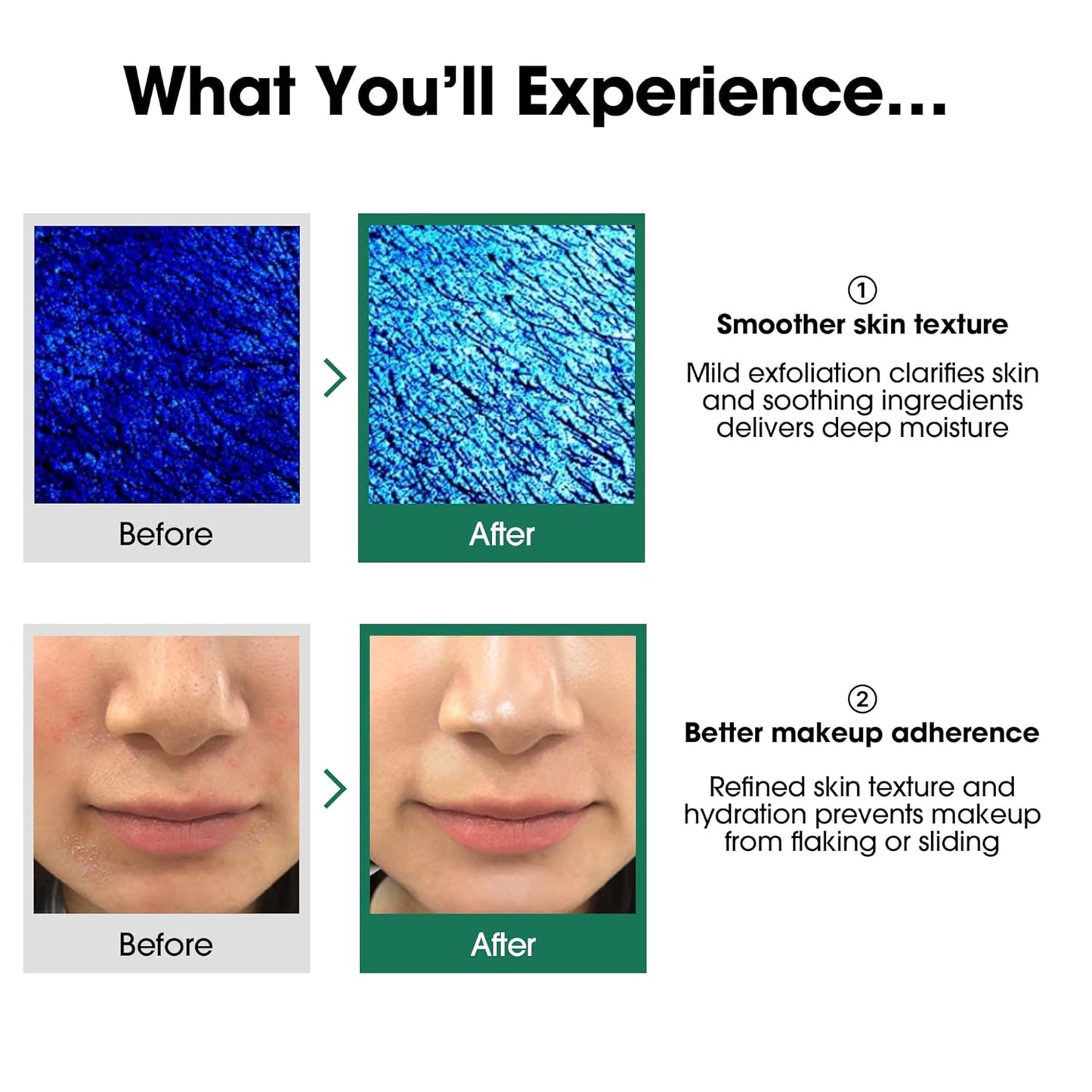 Tea tree Miracle toner 150ml