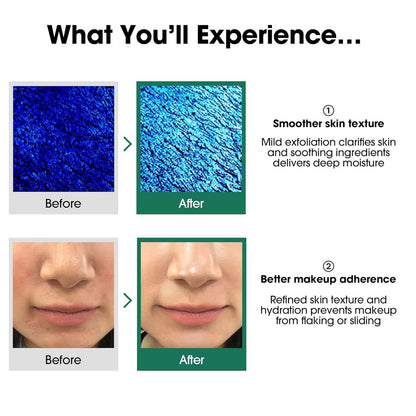 Tea tree Miracle toner 150ml